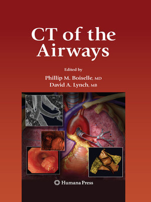 cover image of CT of the Airways